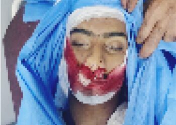 18-years-old Bike rider dies in Cement Kadal accident