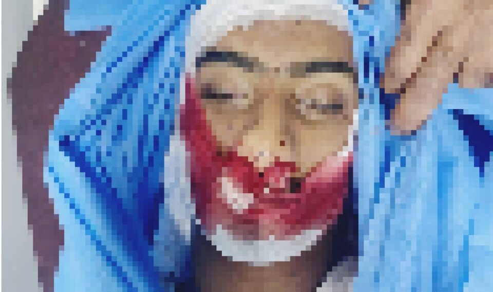 18-years-old Bike rider dies in Cement Kadal accident
