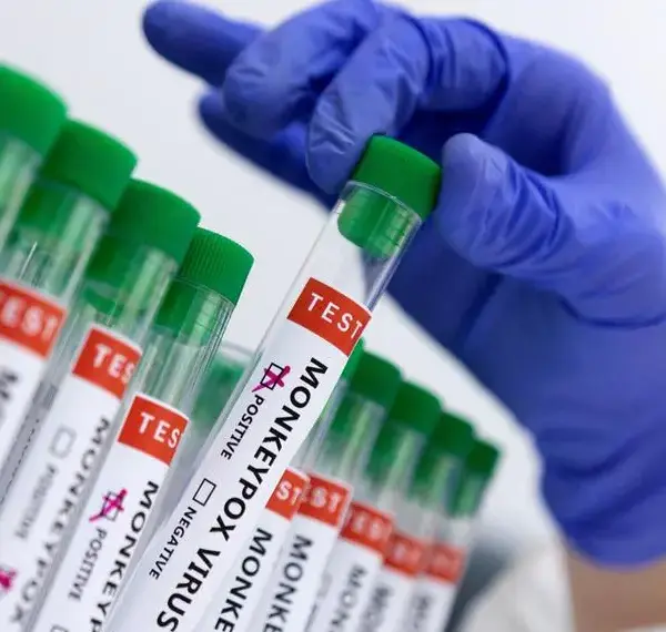 Suspected Mpox case under investigation; patient put under isolation, no cause for alarm