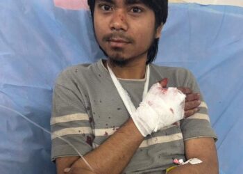 Non-Local Labourer Injured In Tral, Ascertaining How He Got Injured: Top Official