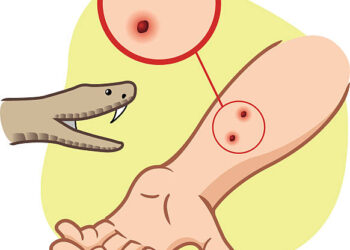 Two Children Die from Snake Bite in JK’s Reasi