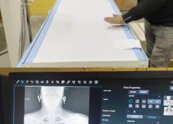 North Kashmir Gets First DR Digital X-Ray Machine at SDH Sopore
