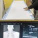 North Kashmir Gets First DR Digital X-Ray Machine at SDH Sopore