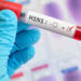 No New H1N1 Strain Detected, ICMR Says; Urges Public Not to Panic